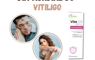 vitiligo